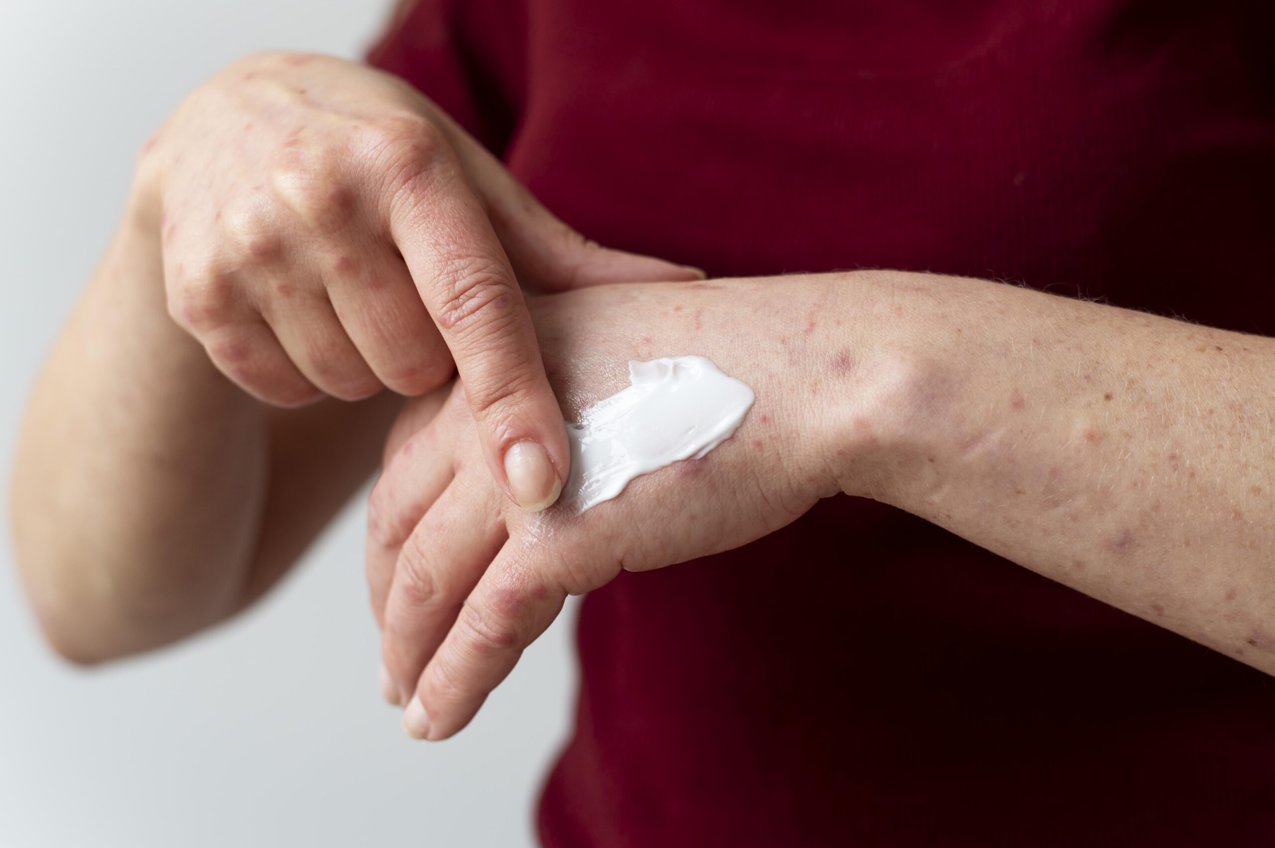 Buni Scar Remover & Body Care for Changing Skin