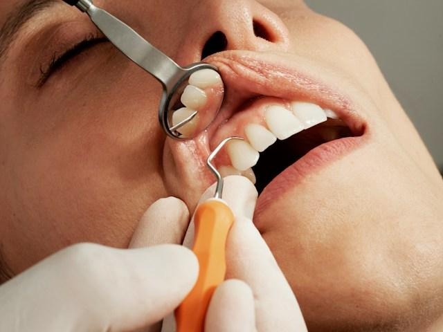 7 Recovery Tips for a Smoother Healing Process After Dental Surgery